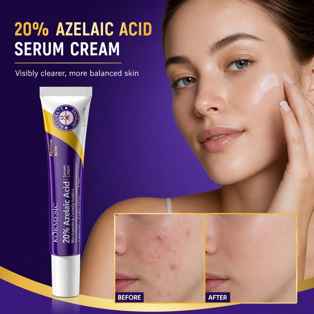 Esencia de Ácido Azelaico al 2 - Luxury Skincare Brands reseña y precio
